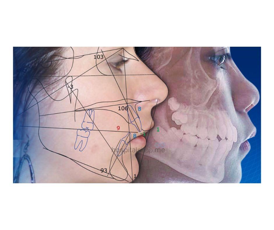Dolphin Imaging Plus Dental Software